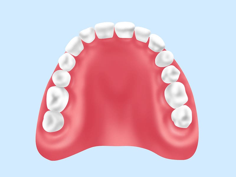 保険の入れ歯（義歯）